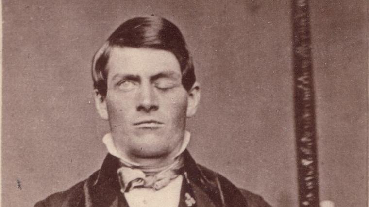 Hlavou mu proletěla železná tyč. Phineas Gage přežil, začal se chovat jinak a změnil neurologii
